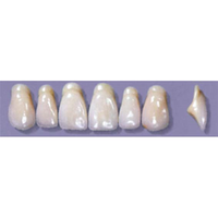 MYERSON ANTERIORS #A13/65 (1x6CARD) Card